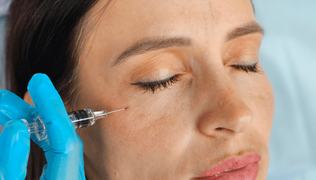 Tear Trough Filler